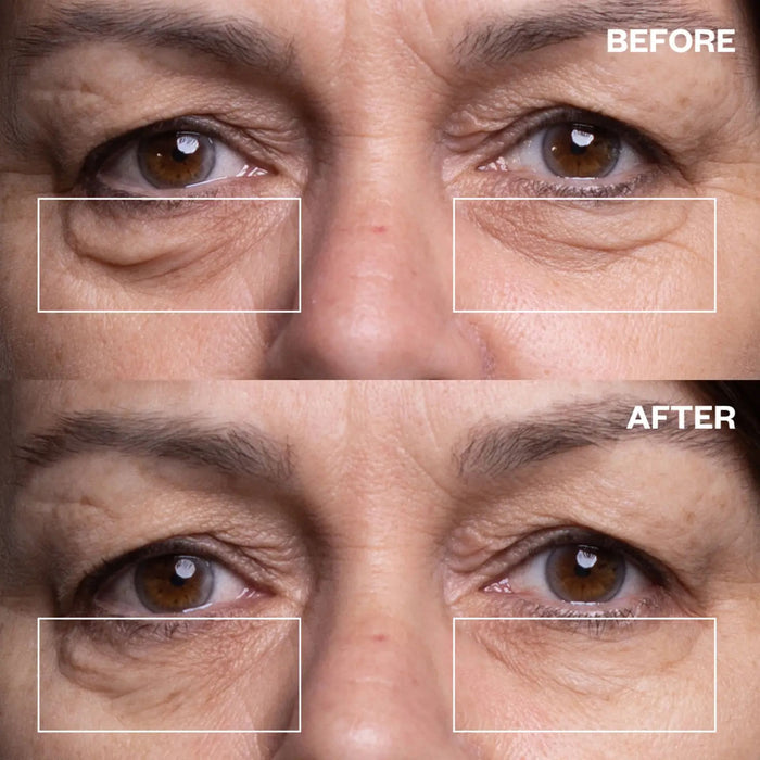 Eye Wrinkle Patches