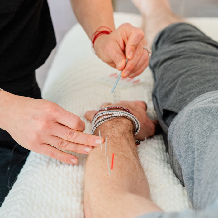 Foundation in Acupuncture (Level 2)